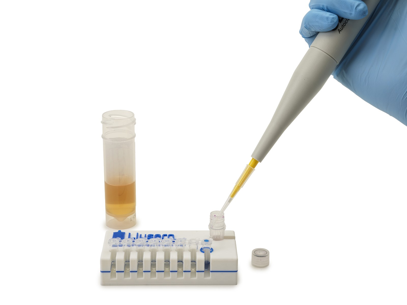 Urine being pipetted into the diluent tube