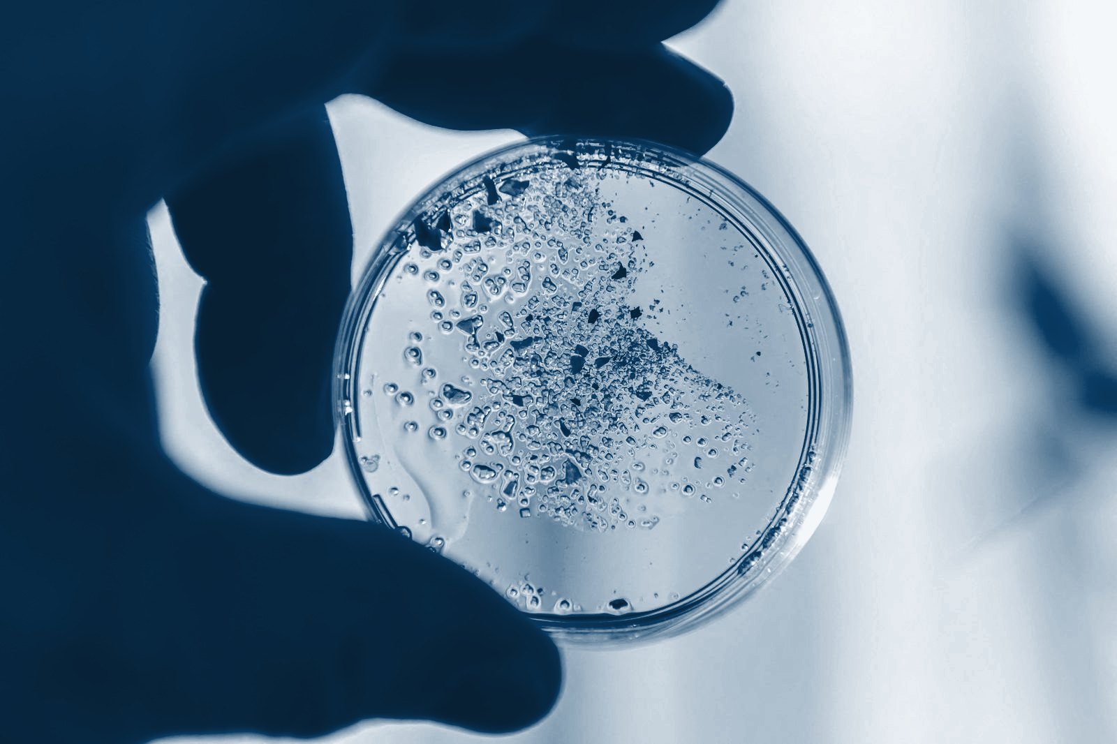 Gloved hand holding a culture plate